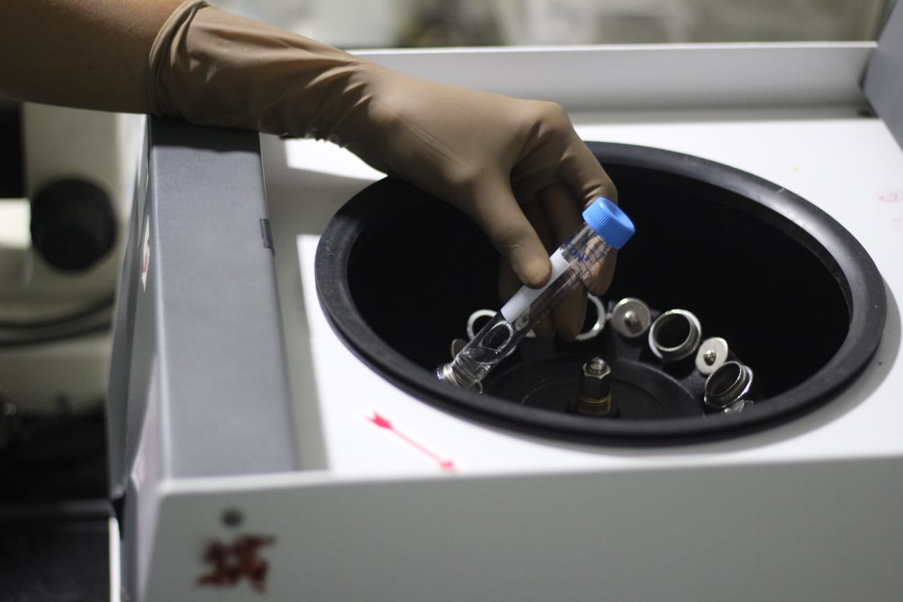 IVF Treatment Process
